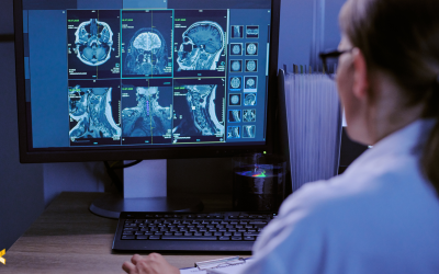 Clinical Trial Monitoring: How Real-Time Data Helps Spot Risk Earlier